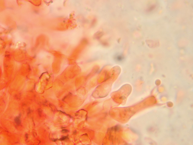 Sistotrema brinkmannii